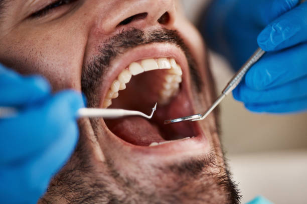Best Emergency Tooth Extraction in Ashaway, RI